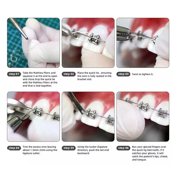Lace Back Wire (Ligature Wire)