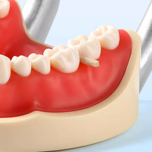 Dental Wooden Wedges